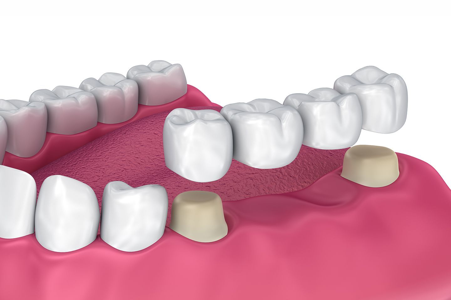 Professional BOTOX care at Serenity Dental in Beaumont