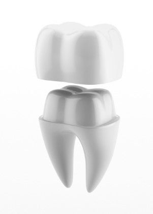 Dental crowns in Beaumont, AB