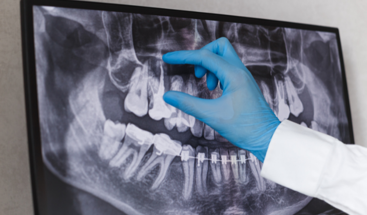 general dental in beaumont