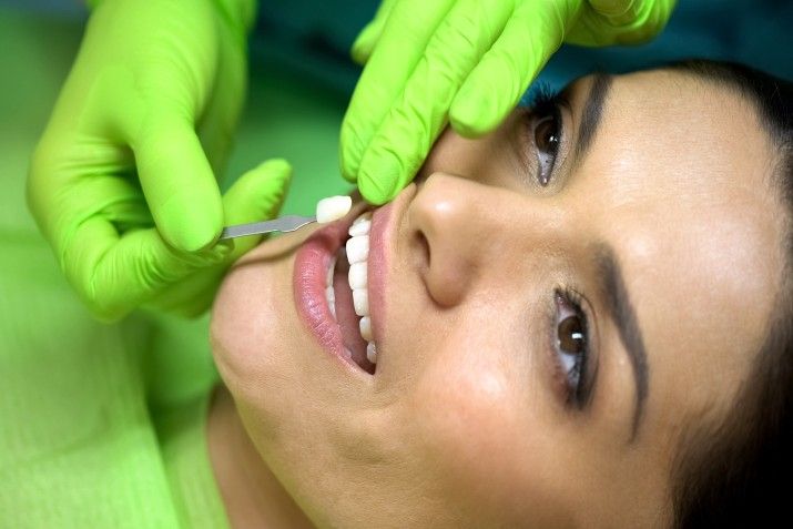female patient getting porcelain veneers in beaumont at serenity dental