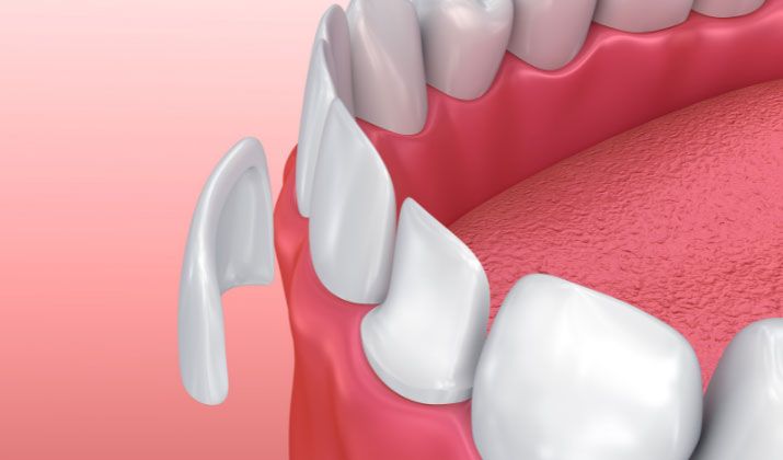 Cosmetic Dentistry in Beaumont